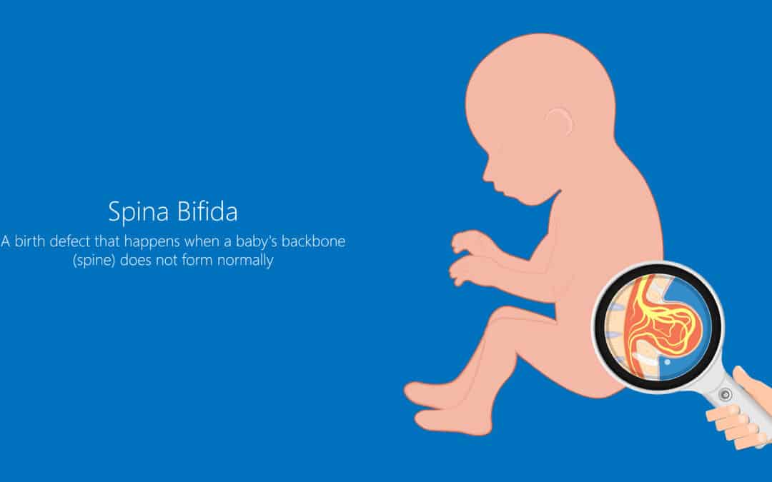 Driving positive change for children with spina bifida and related disabilities in Nigeria